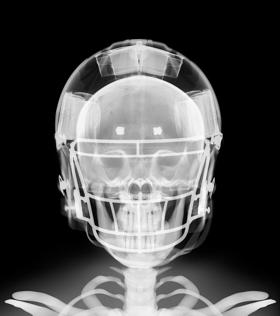 Skeleton in American football helmet, X-ray