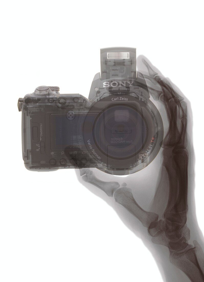 Hand holding a camera, X-ray