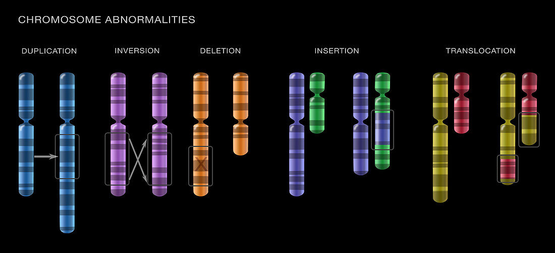 Illustration showing chromosome abnormalities