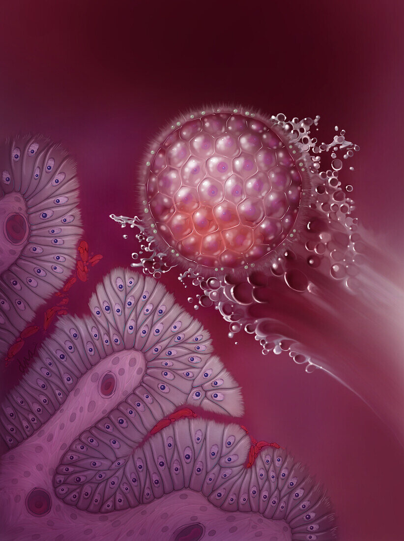 IVF Blastocyst Transfer, Illustration