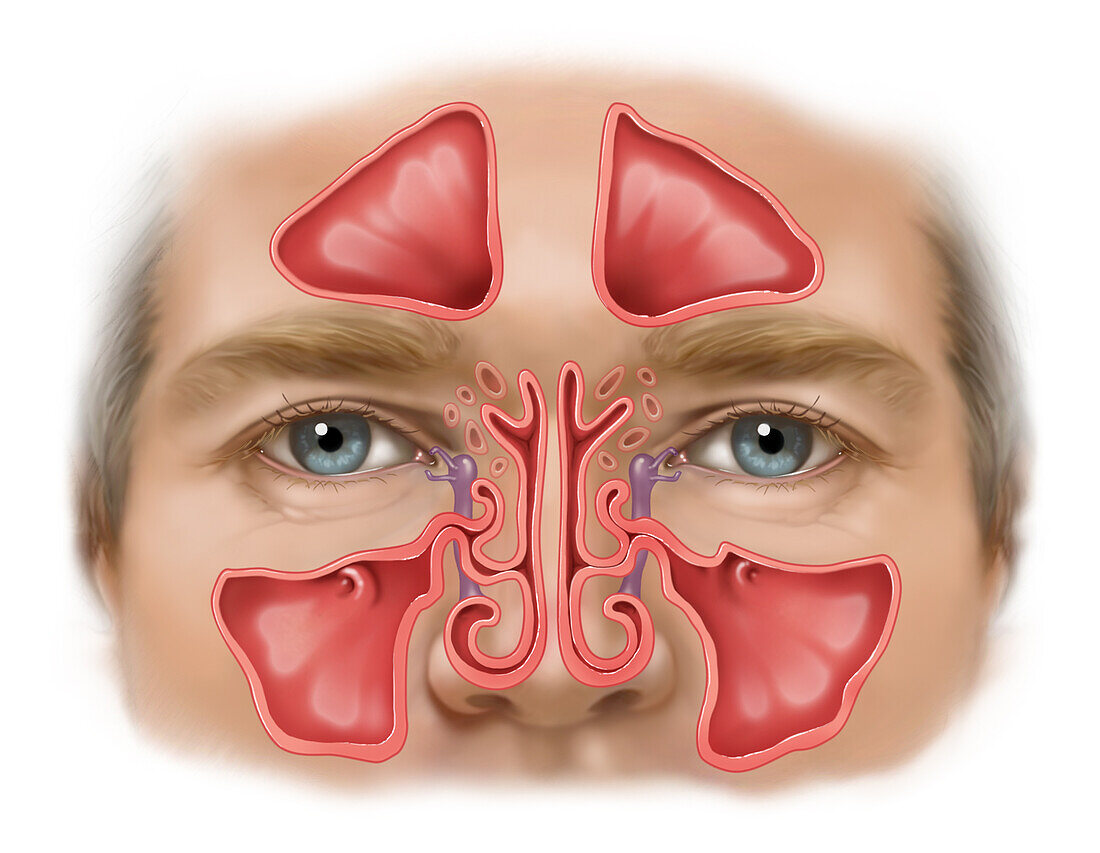 Swollen Sinuses with Nasolacrimal Glands, Illustration