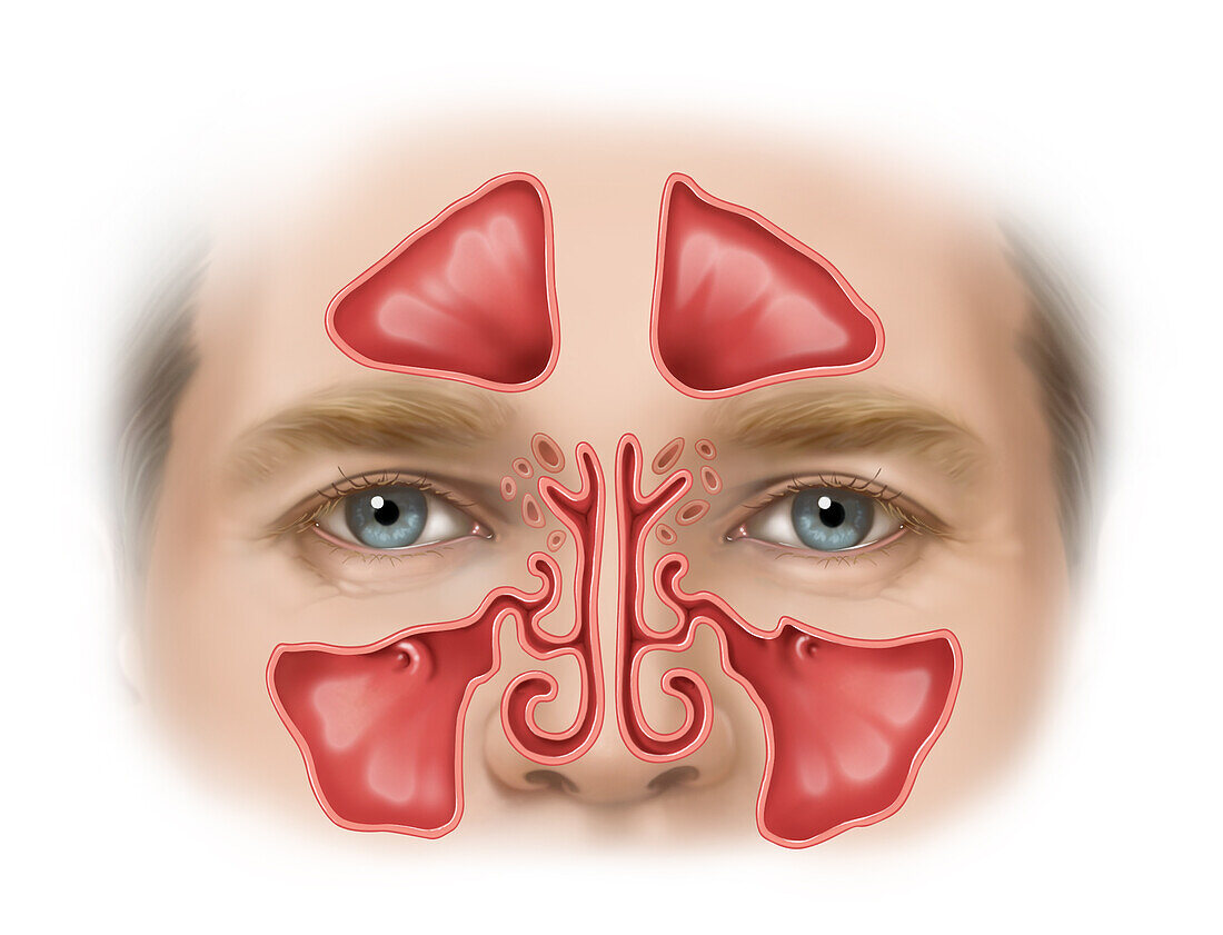 Normal Sinuses, Illustration