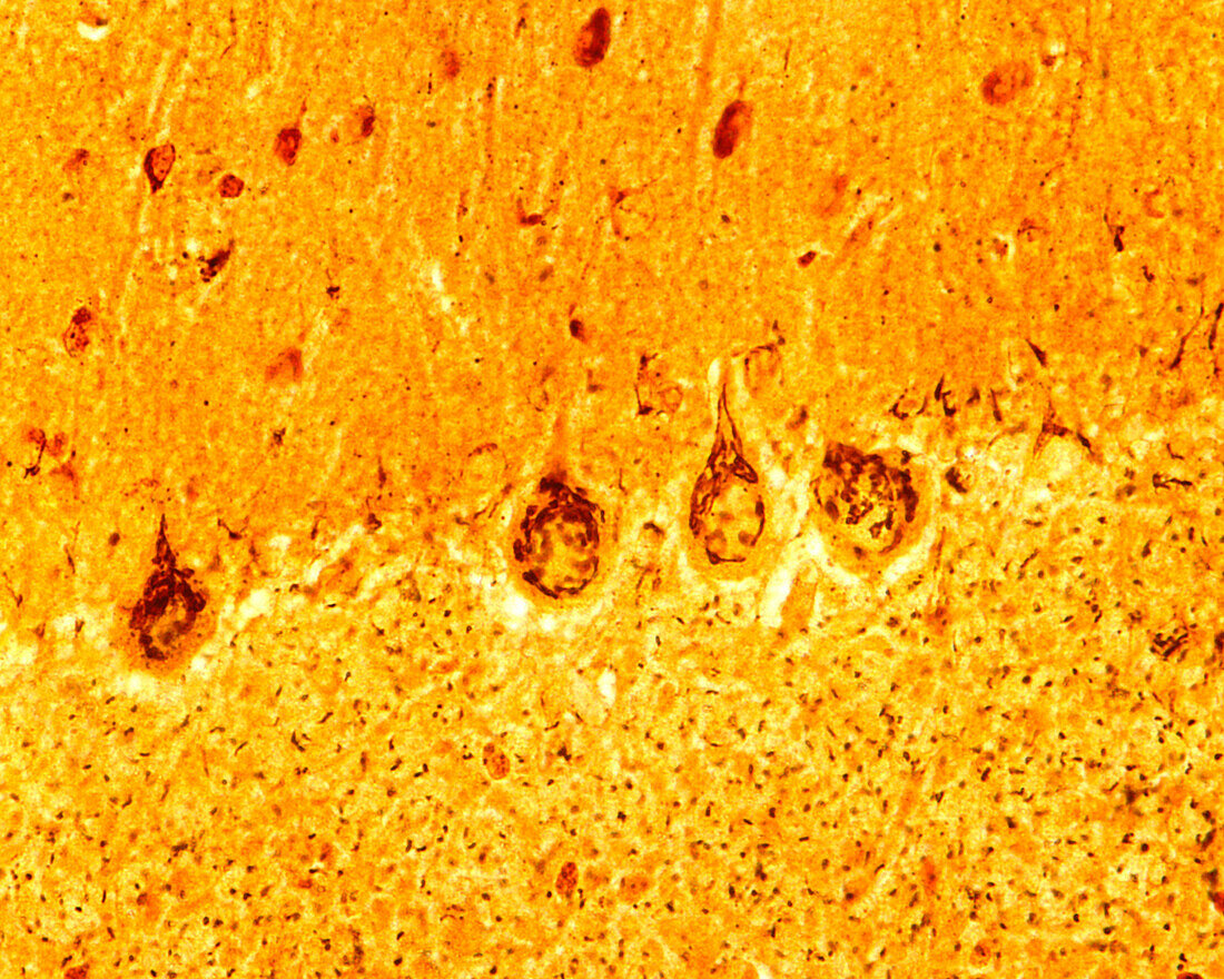 Purkinje Neurons, Golgi Apparatus, LM