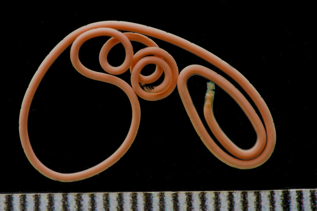 Parasitic Roundworm