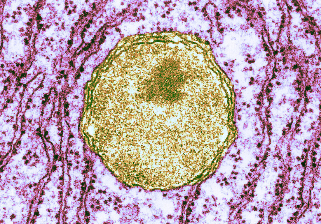 Peroxisomes, TEM