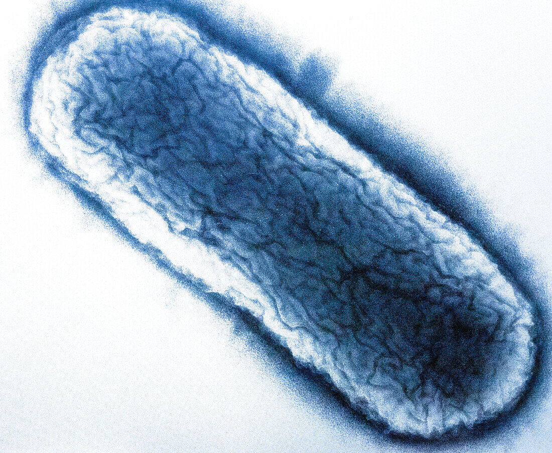 Coliform Bacteria , TEM