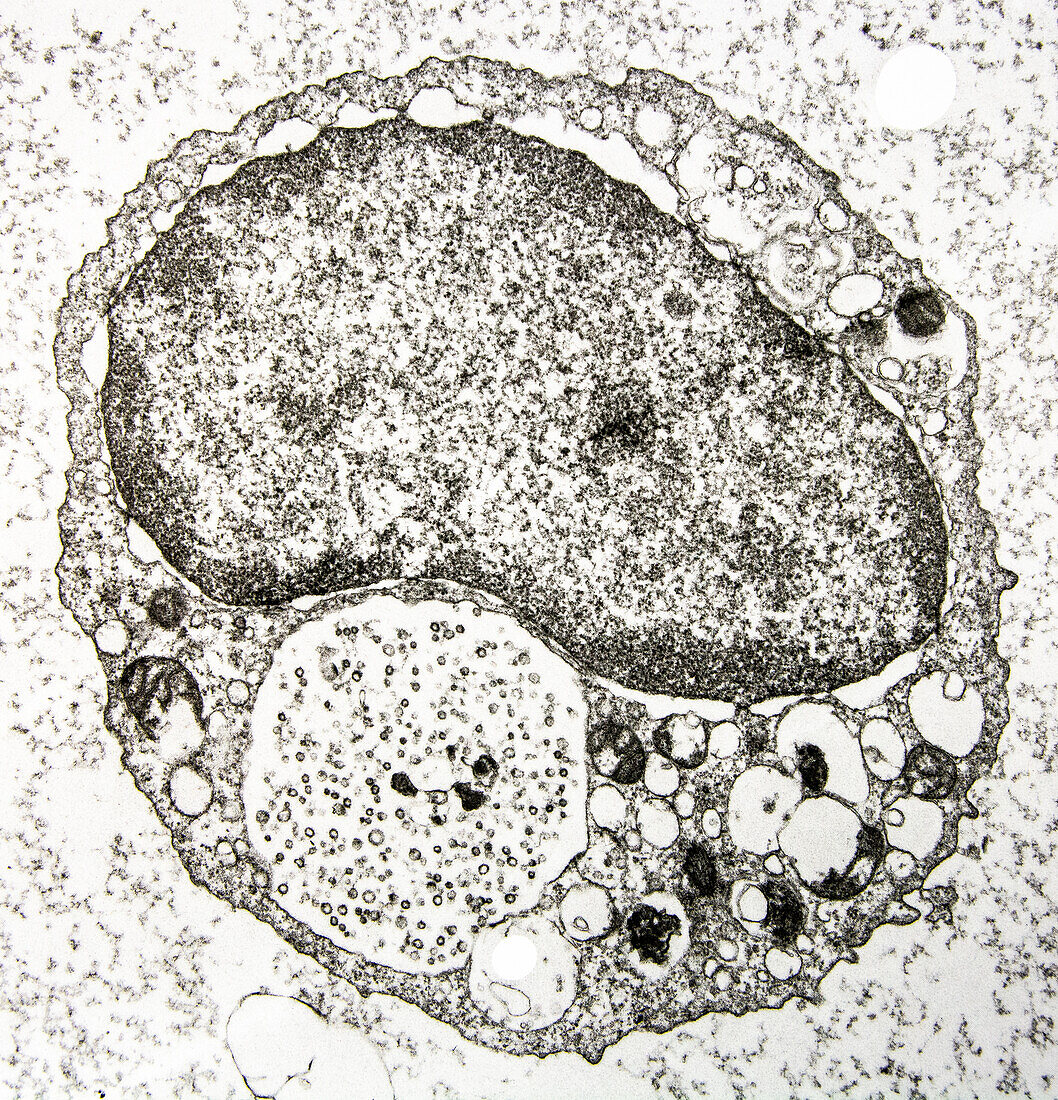 Megakaryocyte, EM