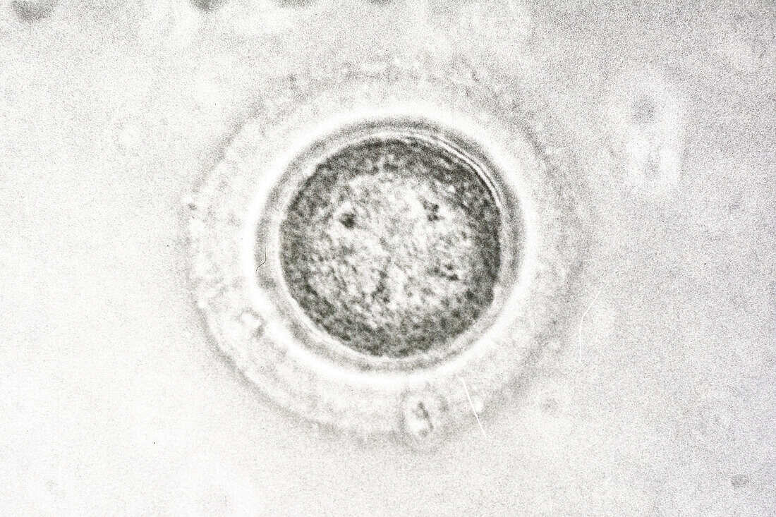 Human Egg Cell (Ovum), LM