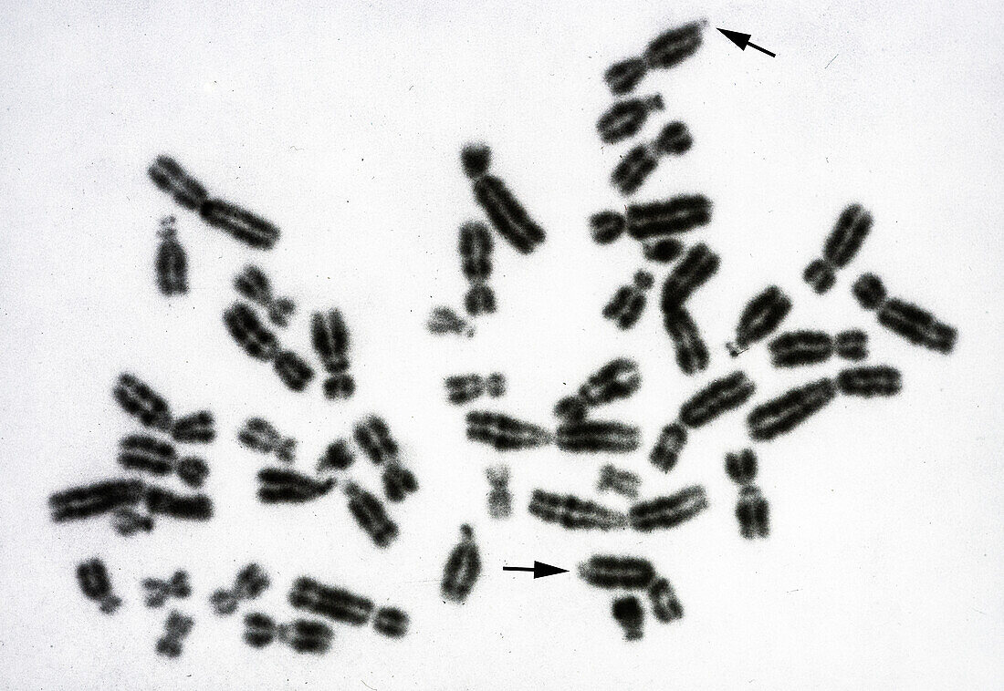 Female Metaphase Plate, G-Stain
