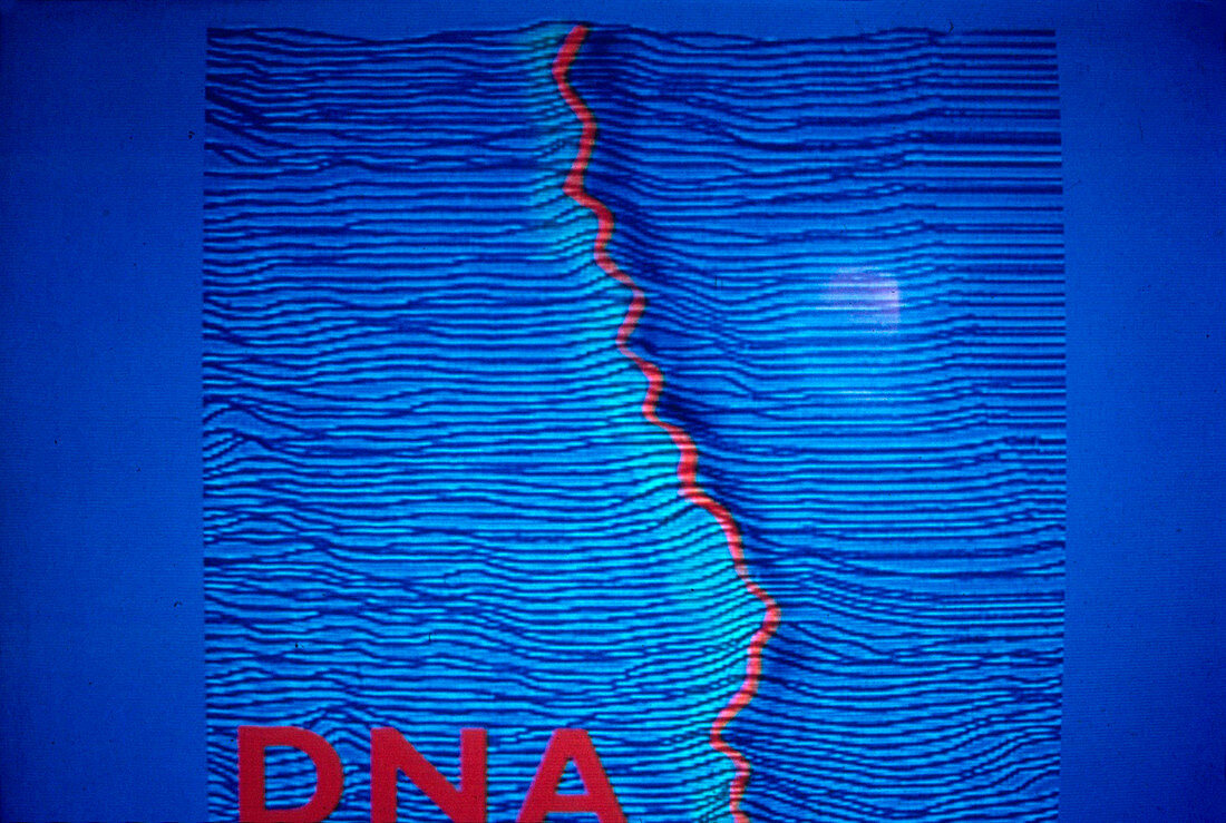 DNA molecule, STM