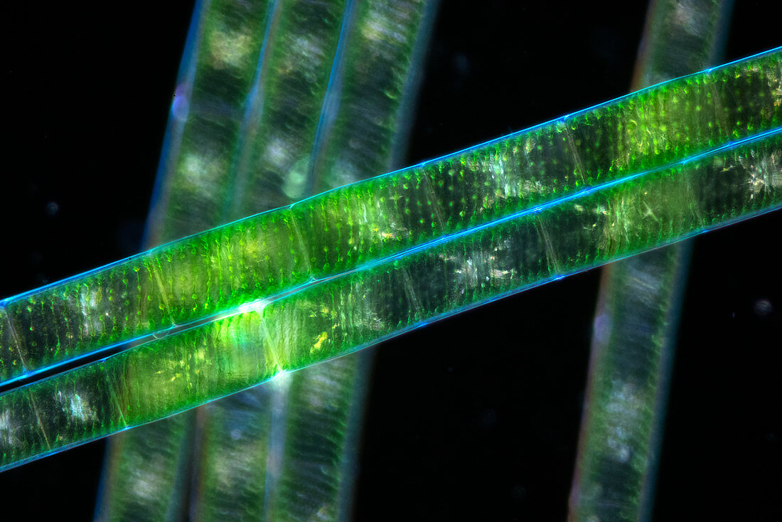 Spirogyra alga, polarised light micrograph