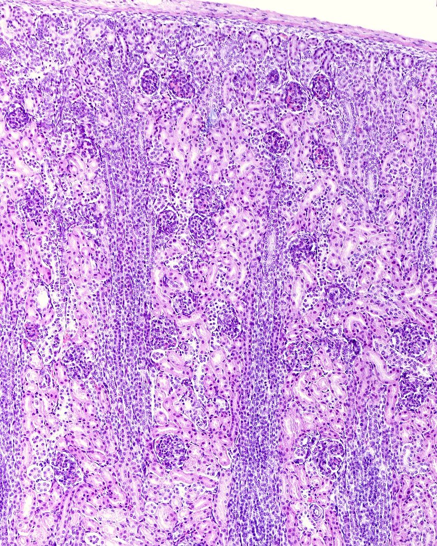 Immature kidney cortex, light micrograph