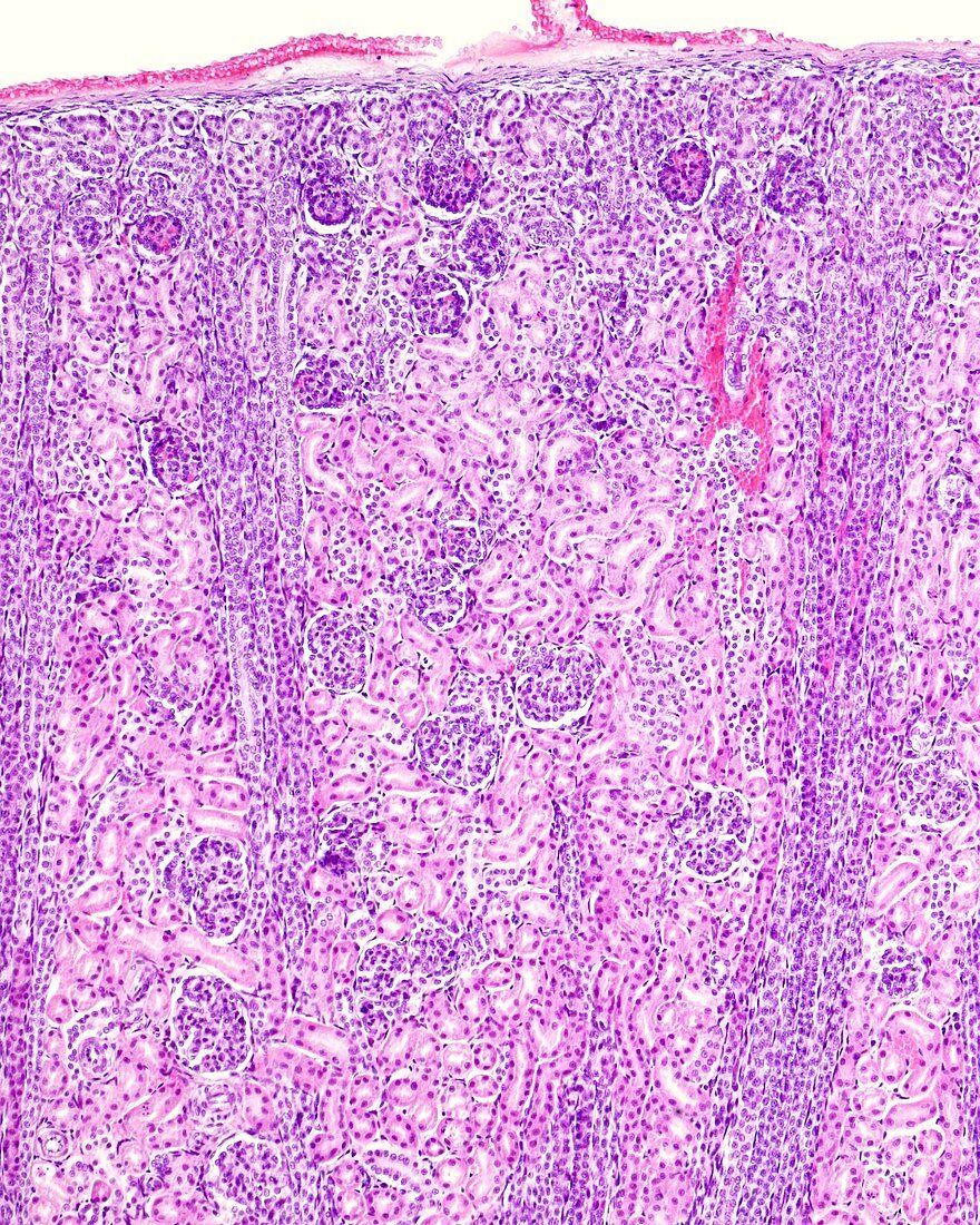 Immature kidney cortex, light micrograph
