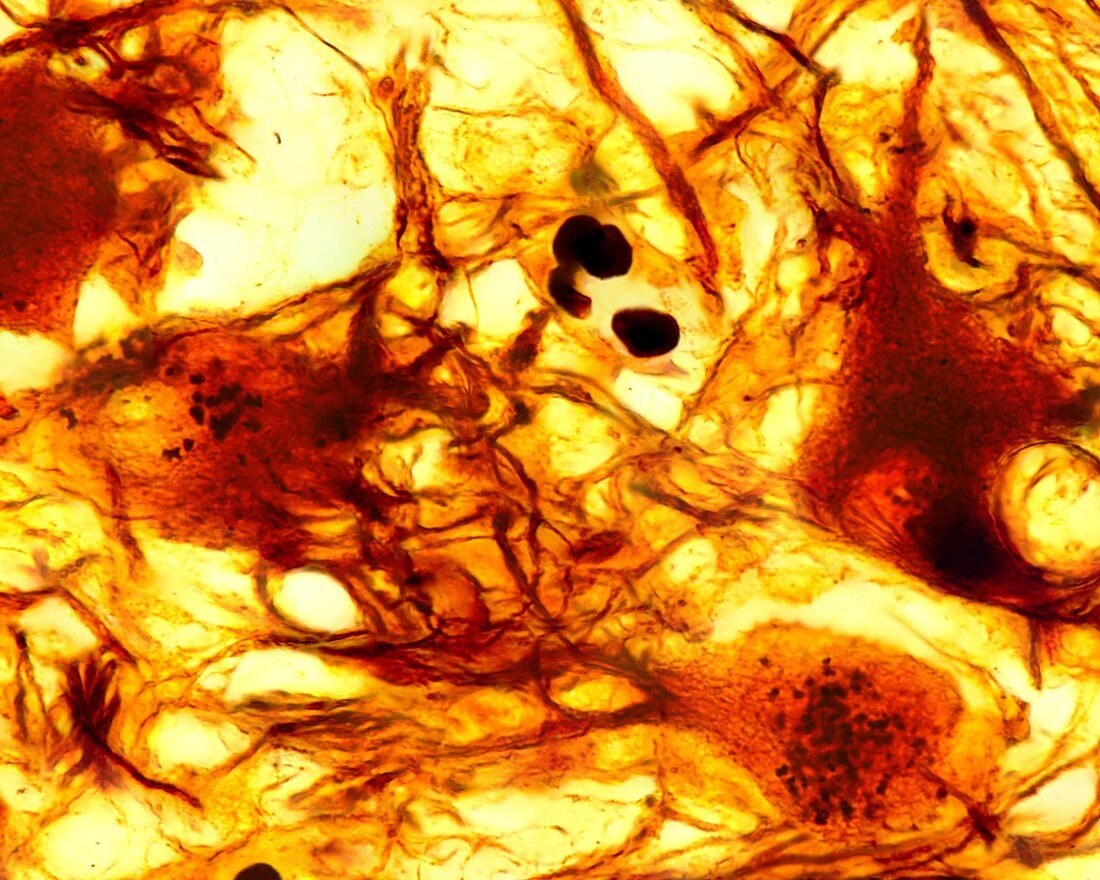 Sympathetic neurons, light micrograph