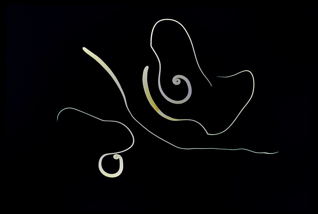 Whipworm parasites, light micrograph