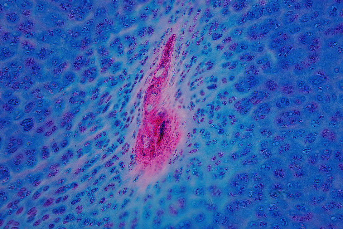 Human hyaline cartilage, light micrograph
