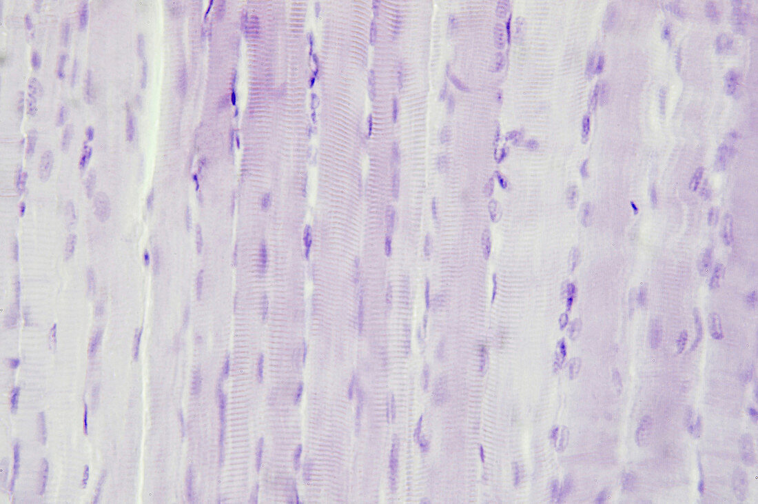 Skeletal muscle, light micrograph
