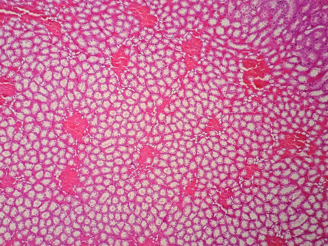 Human kidney tissue, light micrograph