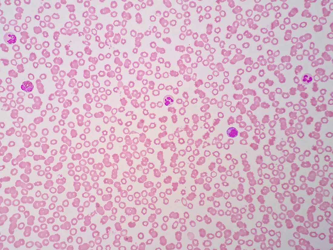 Blood smear, light micrograph