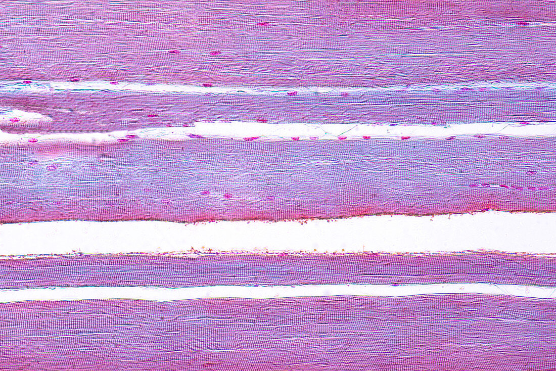 Human skeletal muscle, light micrograph