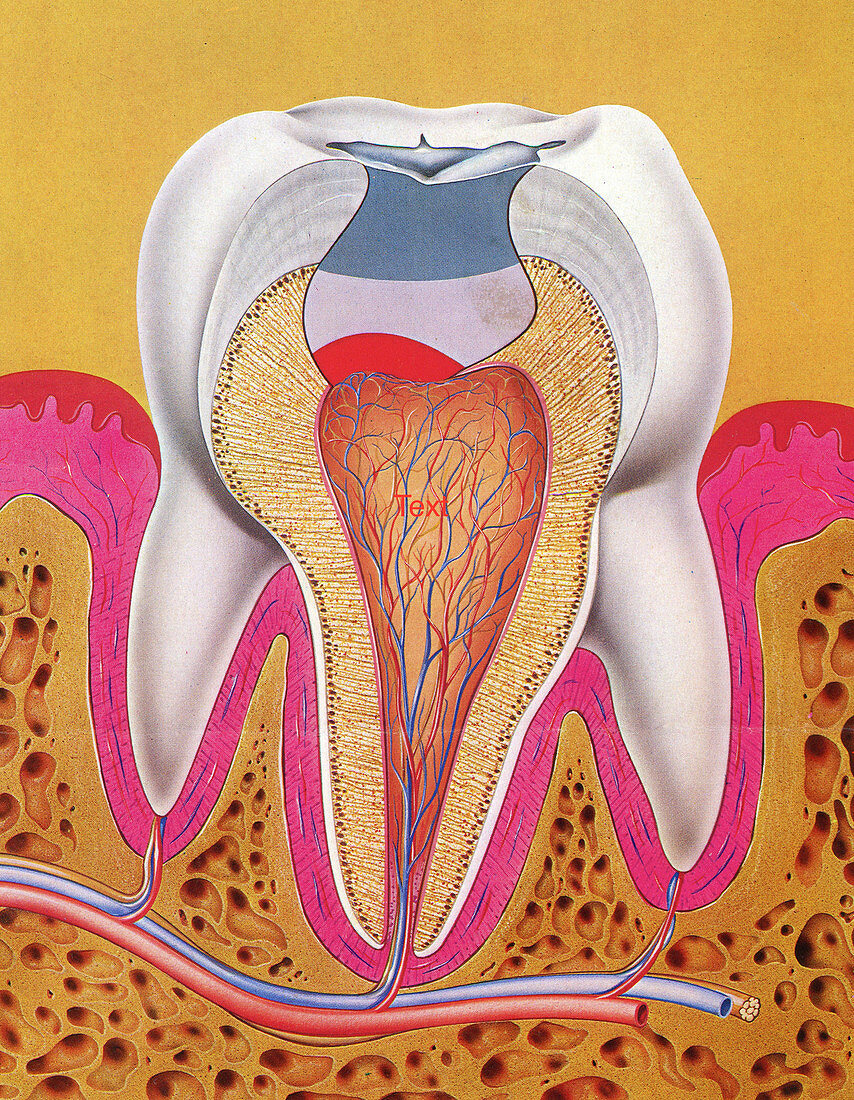 Filling in human tooth, illustration