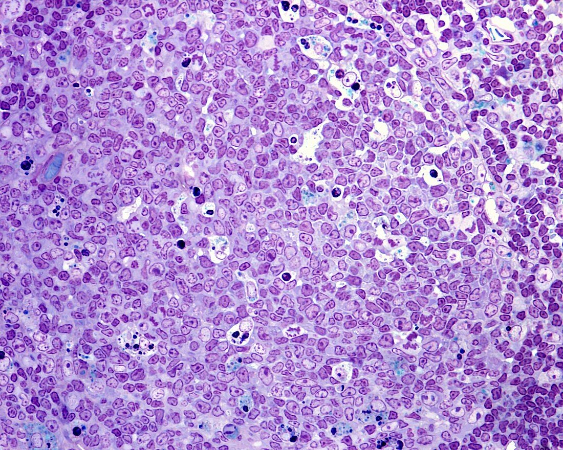 Germinal centre of lymph node follicle, light micrograph