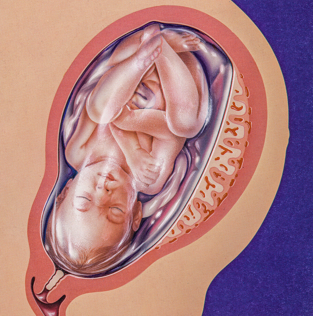 Full term foetus, illustration