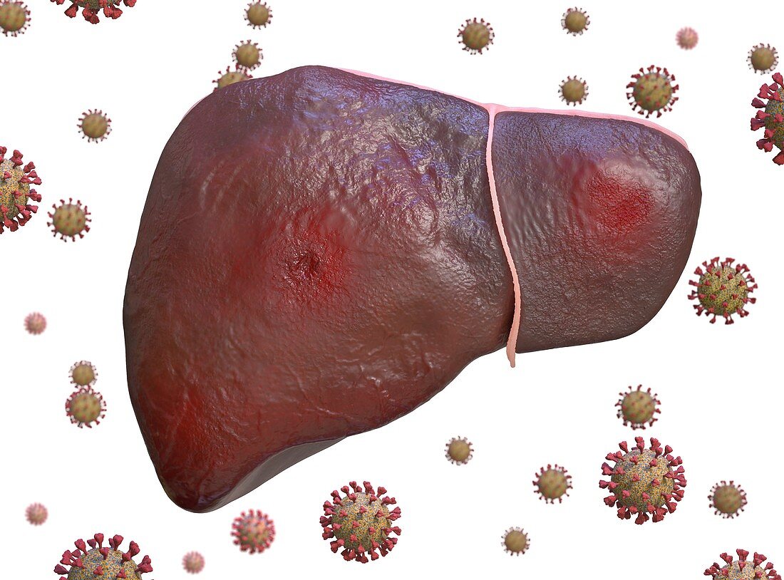 Liver inflammation in Covid-19, conceptual illustration