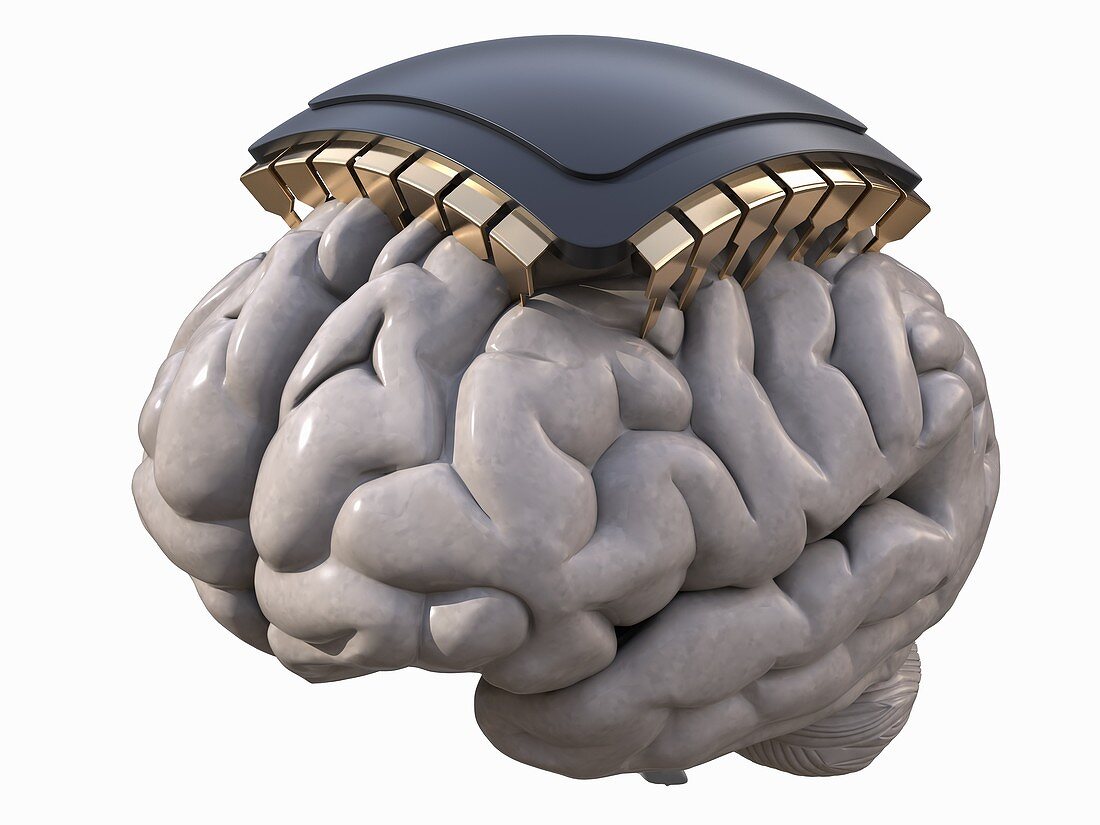 Computer-assisted brain, illustration