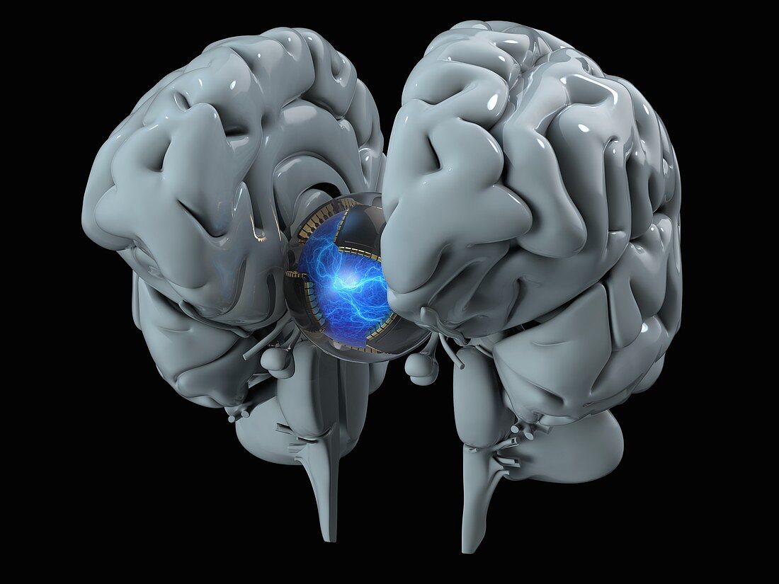 Brain-computer interface, illustration