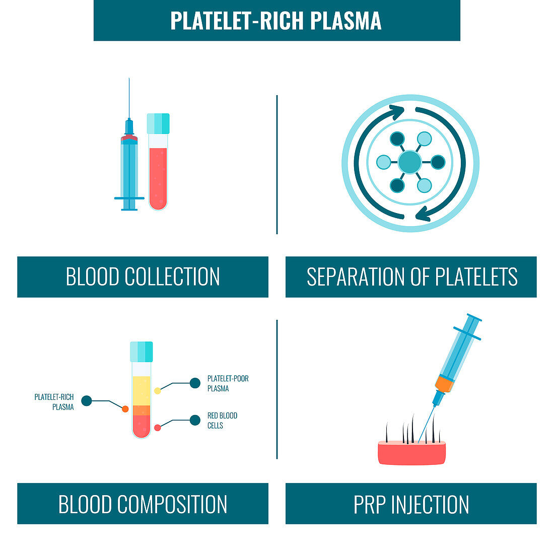 Platelet rich plasma hair treatment, illustration