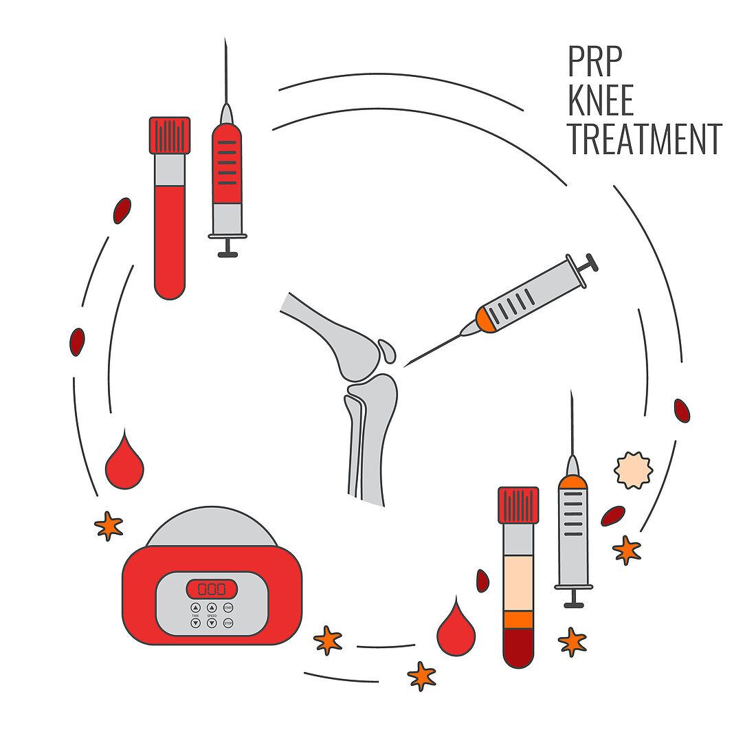 Platelet-rich plasma knee treatment, illustration