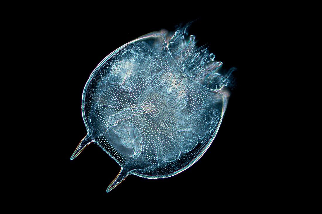 Platyias quadricornis rotifer, light microscopy
