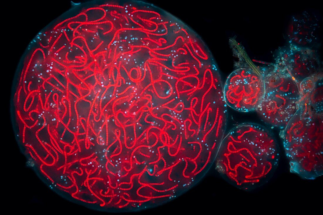 Nostoc cyanobacteria, light micrograph