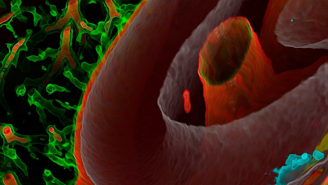 Heart, aorta and lungs, CT scan