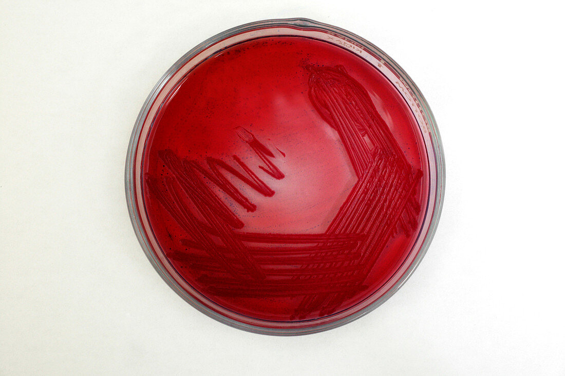 E. coli sample on agar plate
