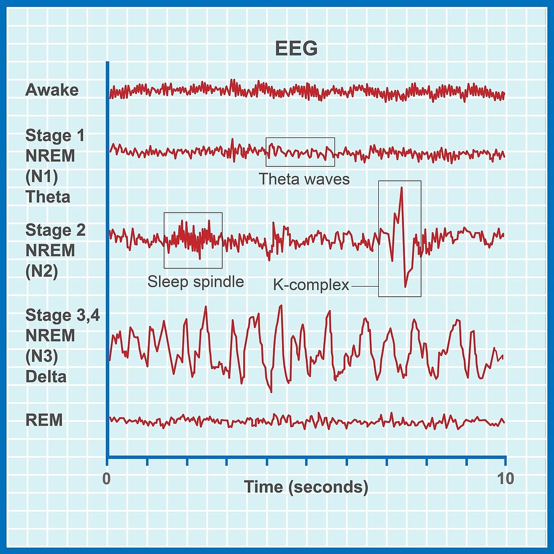 EEG sleep stages, illustration