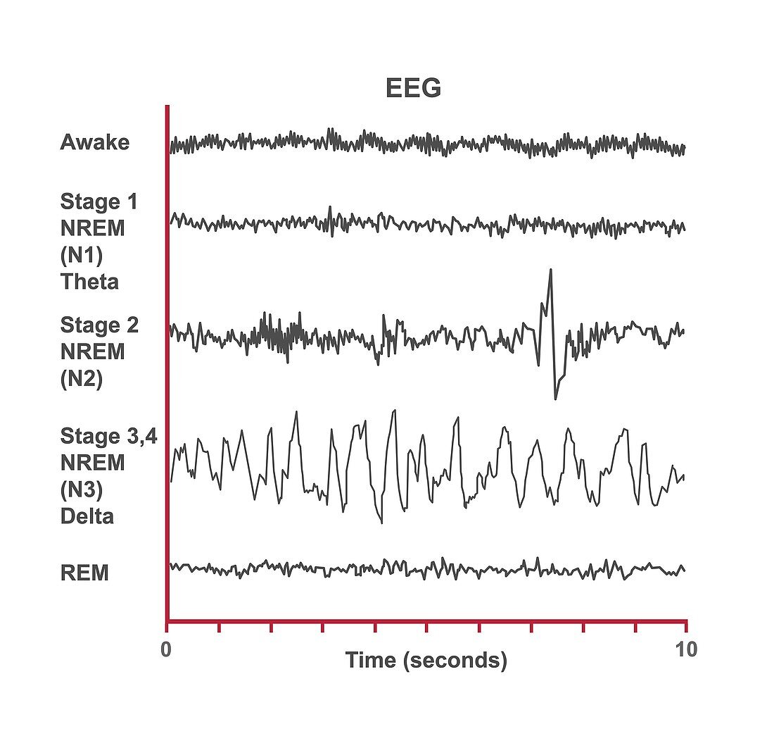 EEG sleep stages, illustration