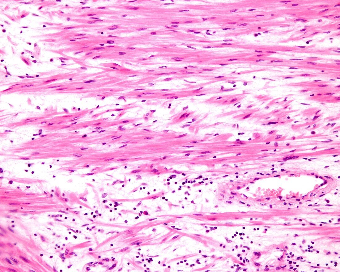 Smooth muscle fibres, light micrograph