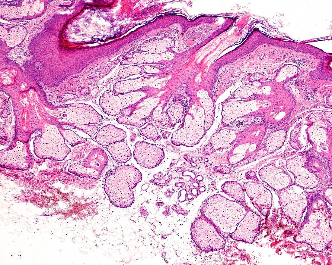 Sebaceous glands, light micrograph