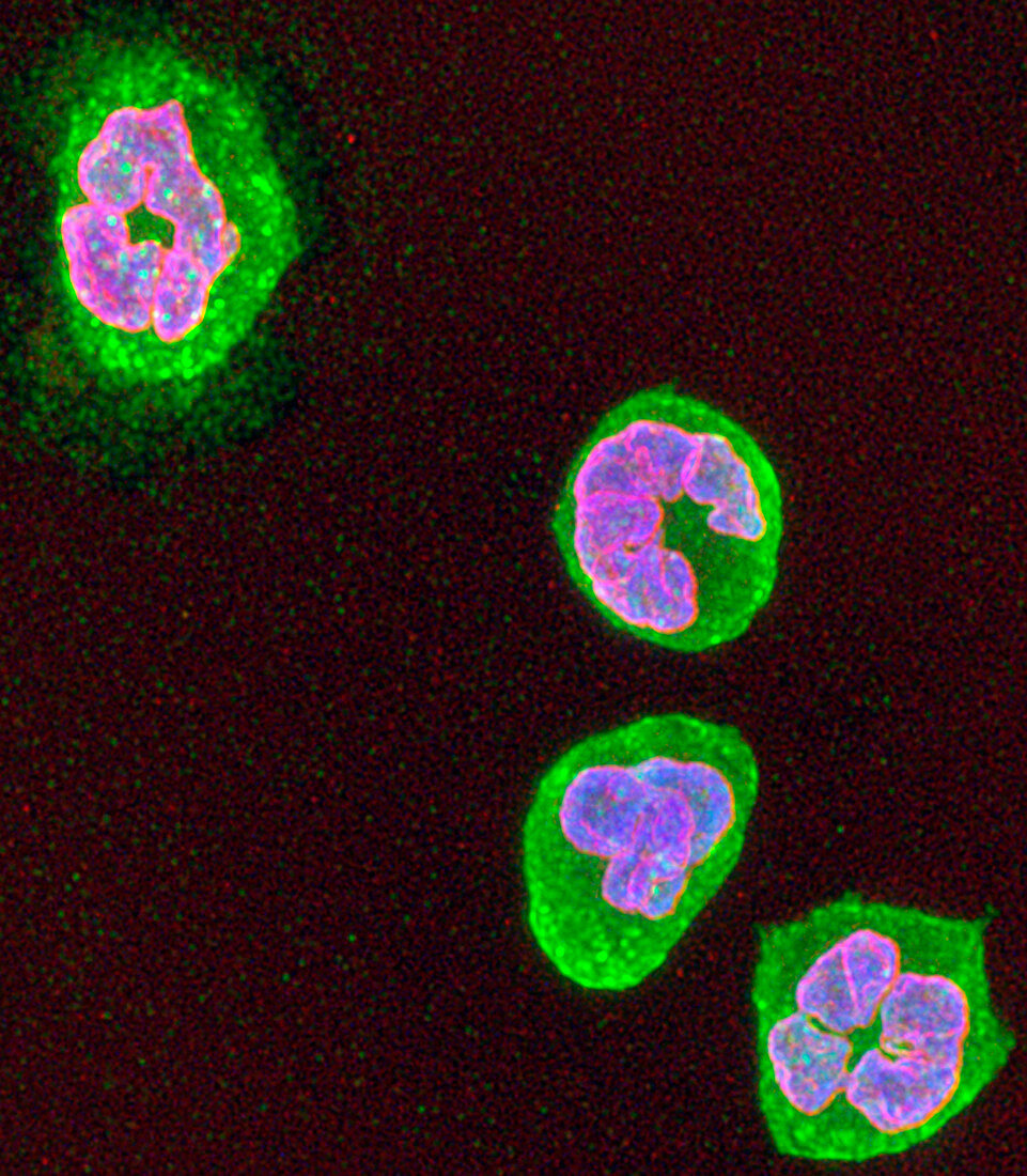 Neutrophil white blood cells, fluorescent micrograph