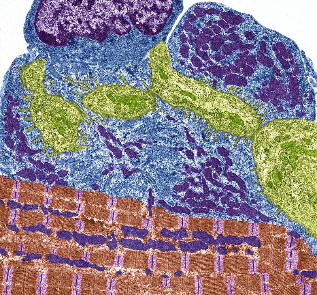 Neuromuscular junction, TEM