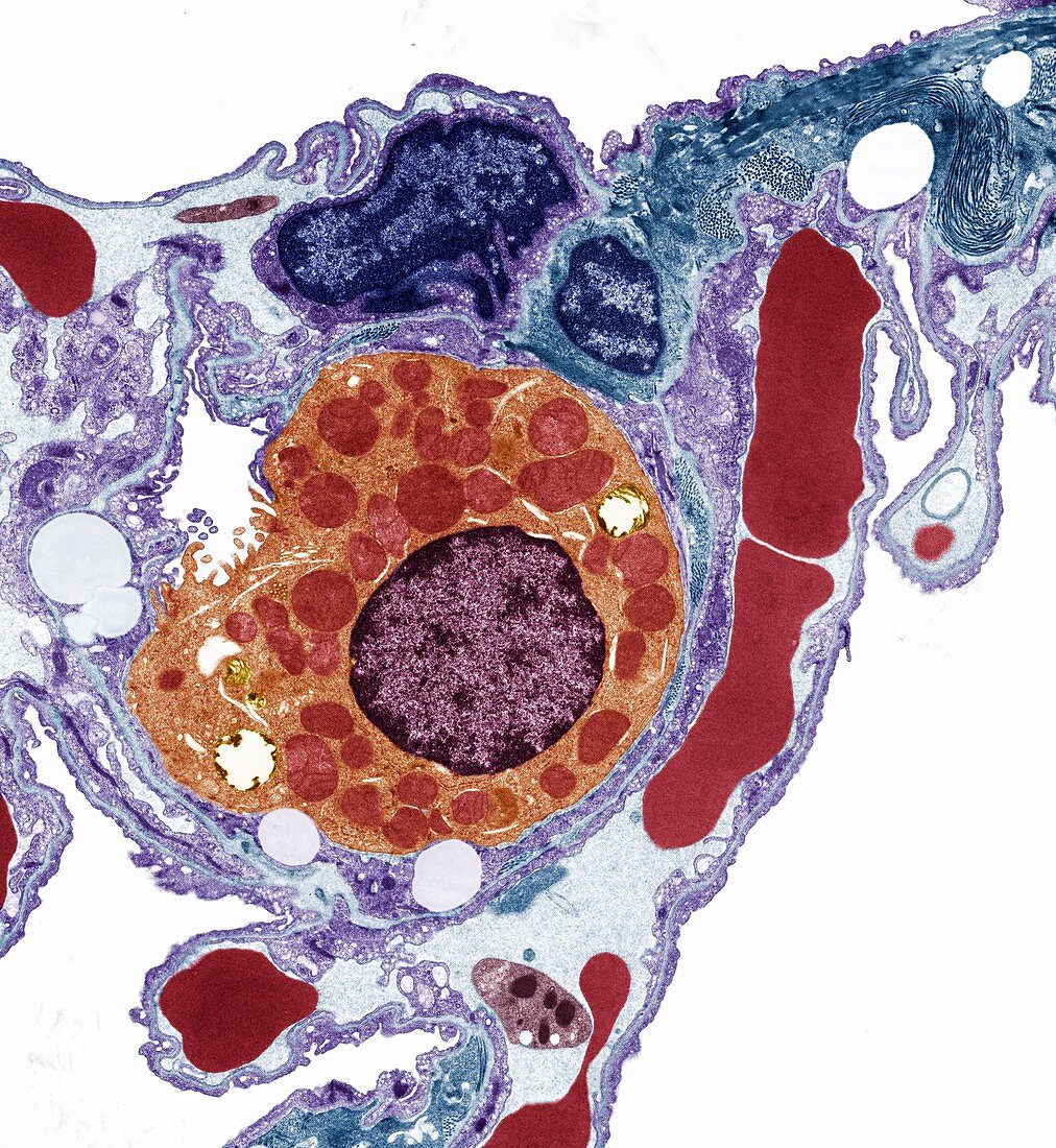 Alveolar cell, TEM