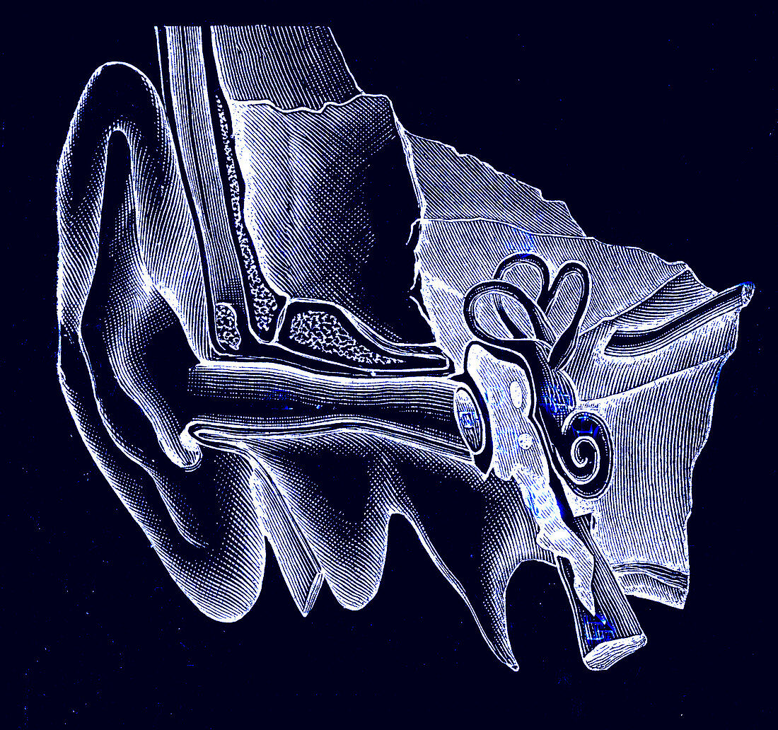 19th Century hearing aid, illustration