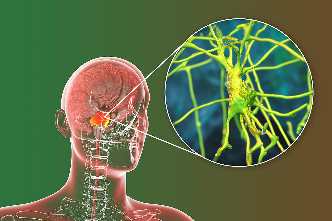 Human brain with highlighted pons and neurons, illustration