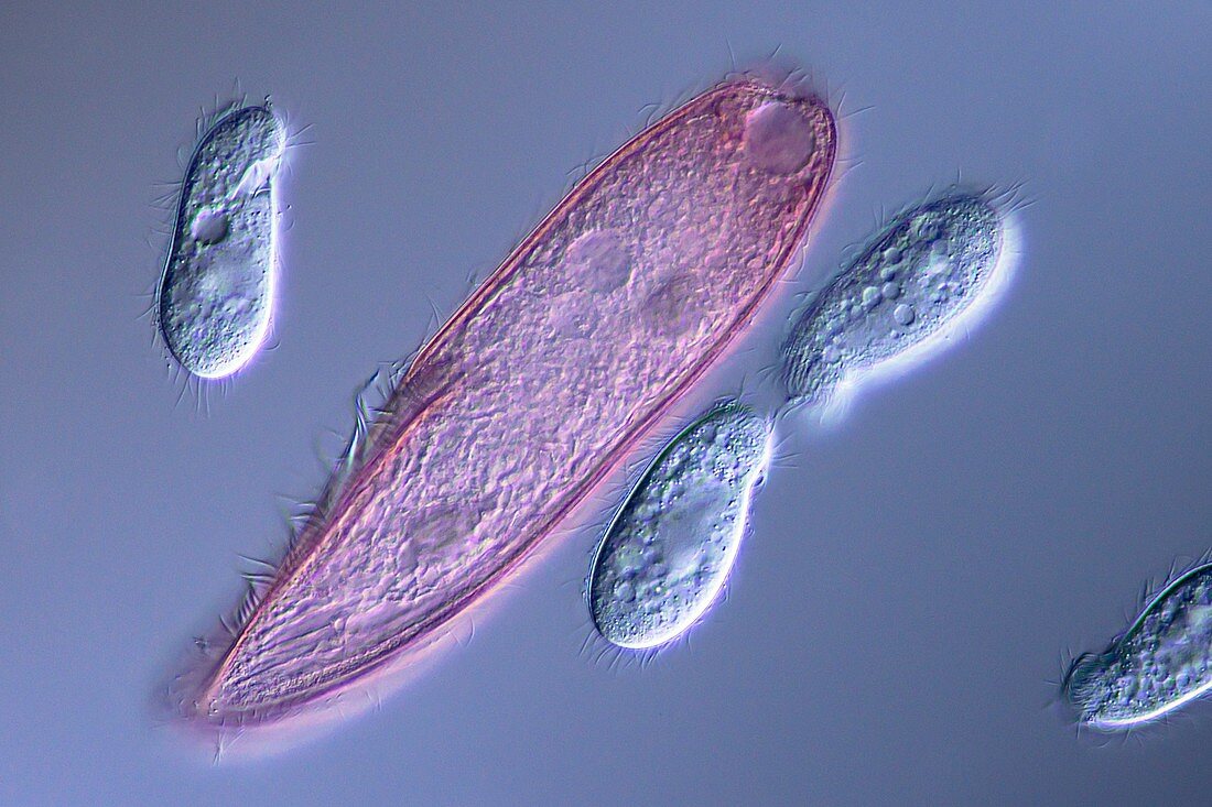 Blepharisma protozoan, light micrograph