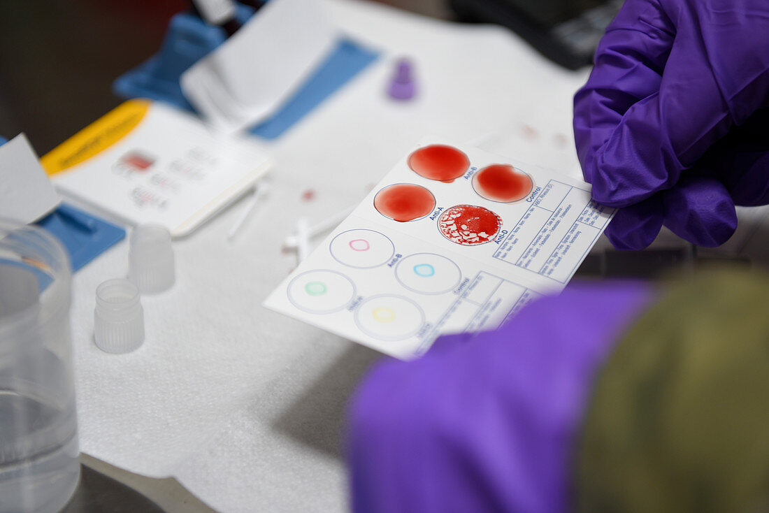 Technician reviewing blood typing test