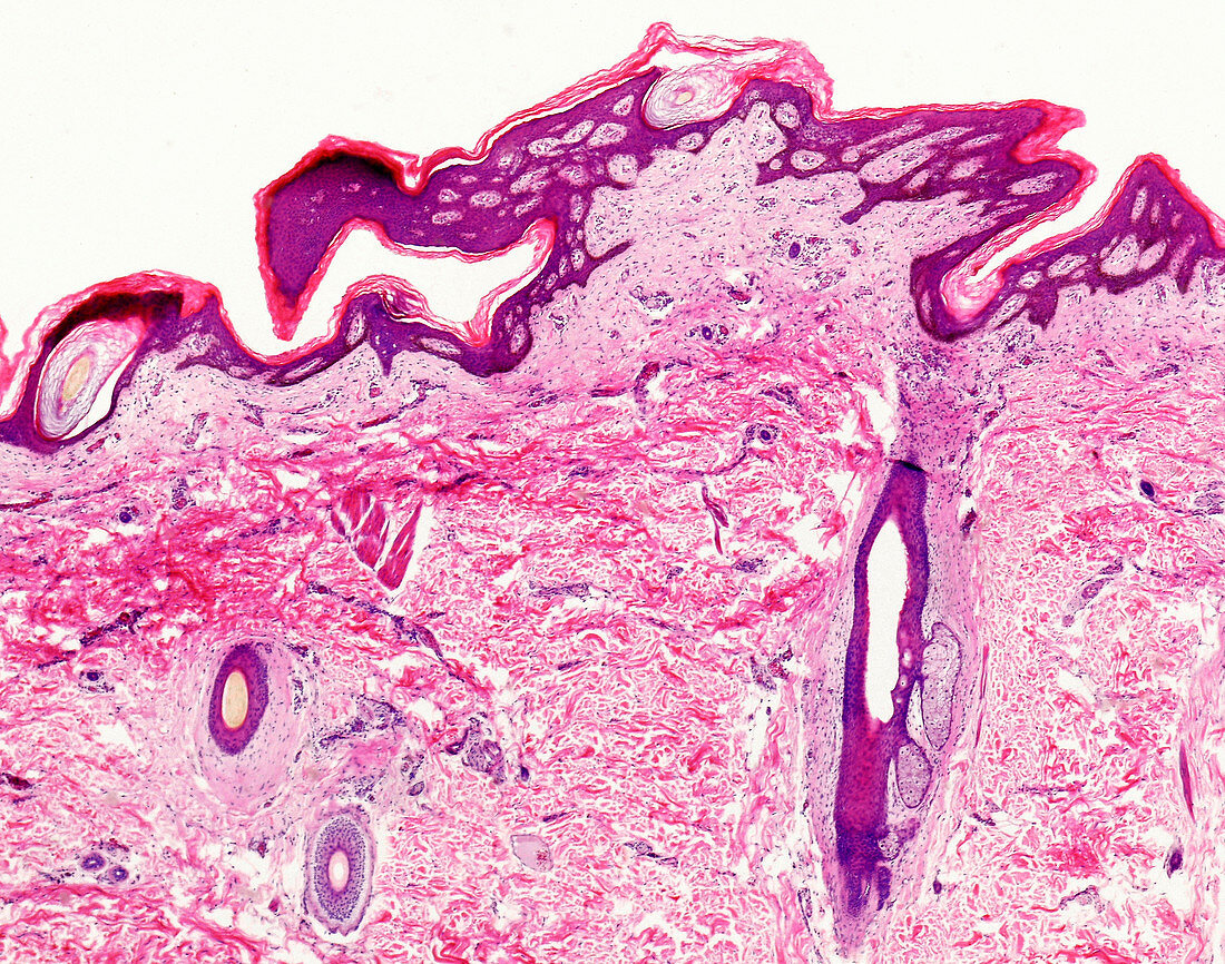 Human rectum and anal canal section, light micrograph