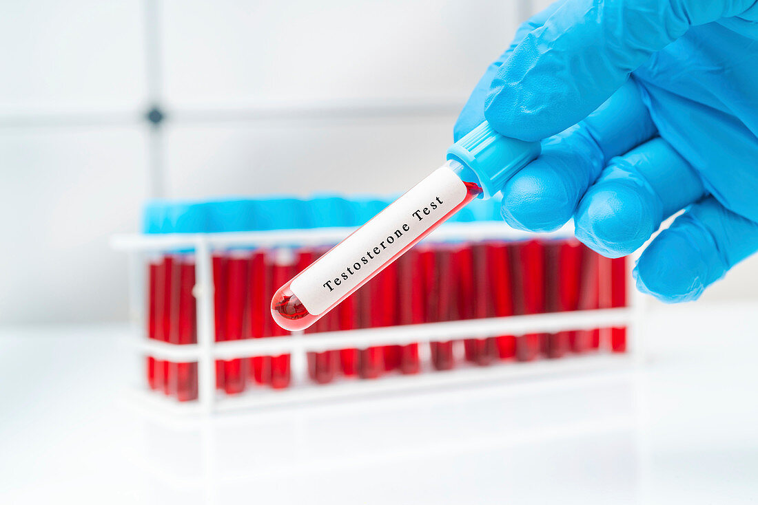 Testosterone blood test, conceptual image