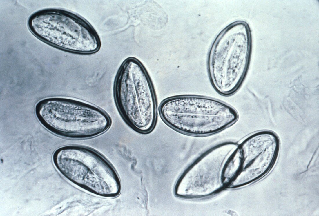 Eggs of human pinworm parasite, light micrograph